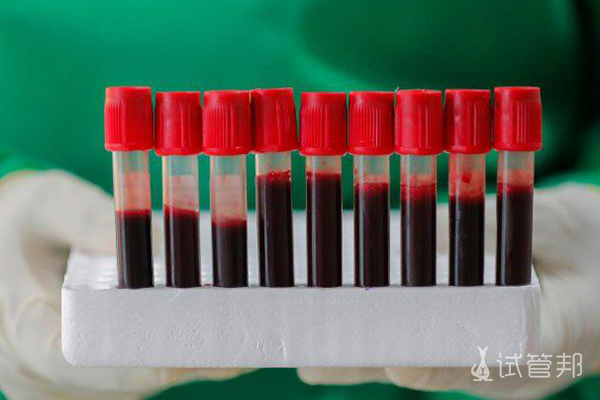 经验总结
:熊猫血（rh阴性血）和O型血有什么区别哪个更好