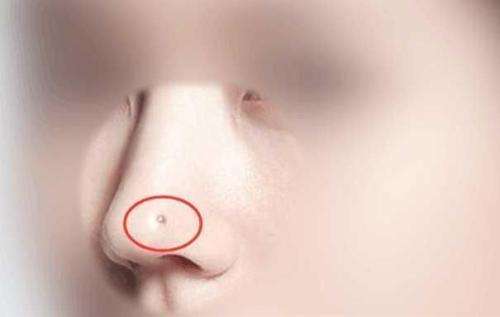 给力
:女人鼻子上有痣图解