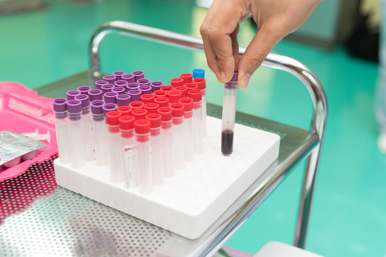 所谓真相
:血型能决定性格和寿命？A型、AB型、B型、O型，哪种更容易患癌？