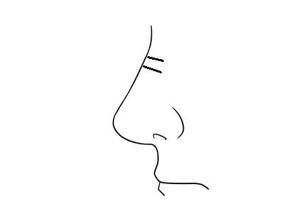 ​男人鼻梁有横纹的面相分析，鼻梁有横纹的男人克妻吗？