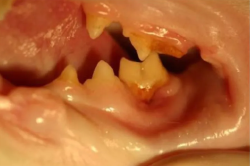 孕妇梦见掉牙齿还出血意味着什么？