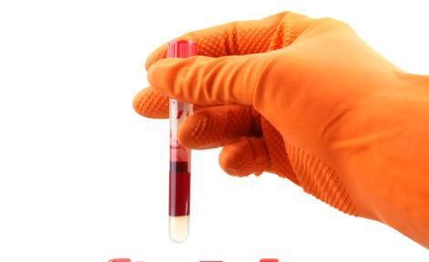 正式公布:不同血型的性格分析由何而来？