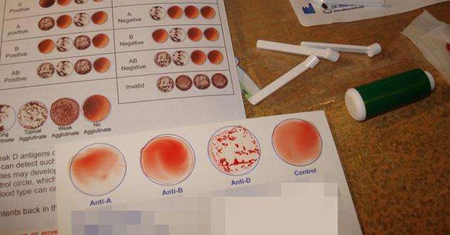 经验分享:ab型血和o血型能生出b型血的孩子吗
