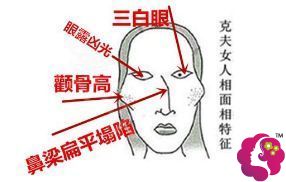 眼界大开
:韩国轮廓整形医生为您解答颧弓外扩和颧骨高...