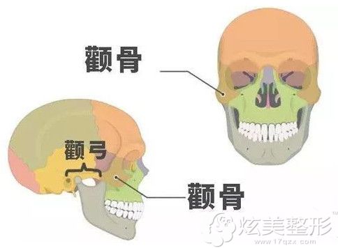 眼界大开
:韩国轮廓整形医生为您解答颧弓外扩和颧骨高有什么区别